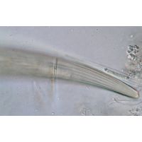 Closterium