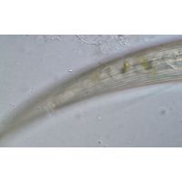 Closterium