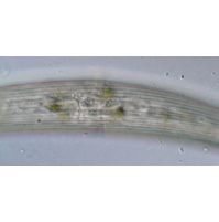 Closterium