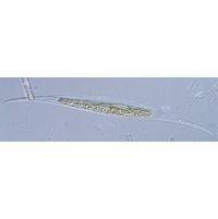 Closterium rostratum