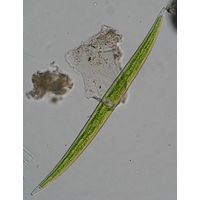 Closterium strigosum