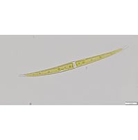 Closterium strigosum