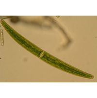Closterium striolatum