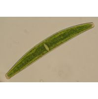 Closterium striolatum