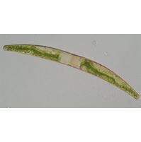 Closterium striolatum