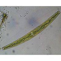 Closterium striolatum