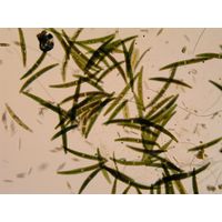 Closterium striolatum