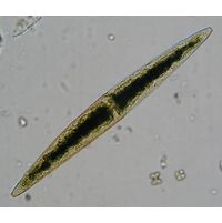 Closterium subfusiforme