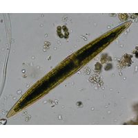Closterium subfusiforme