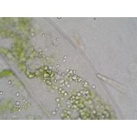 Closterium sublaterale