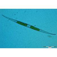 Closterium subulatum