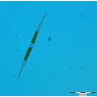 Closterium subulatum