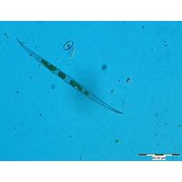 Closterium subulatum