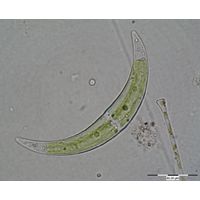 Closterium tumidulum