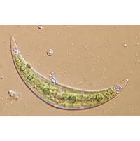 Closterium tumidulum