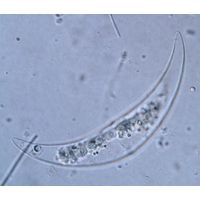 Closterium tumidulum
