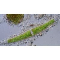 Closterium tumidum