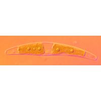 Closterium tumidum