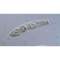 Closterium tumidum