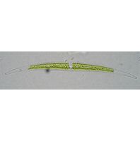 Closterium tumidum