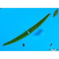 Closterium turgidum