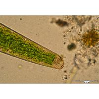 Closterium turgidum