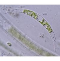Closterium venus