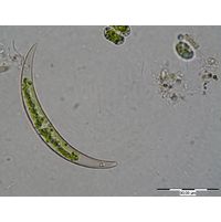 Closterium venus