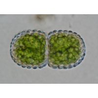 Cosmarium amoenum