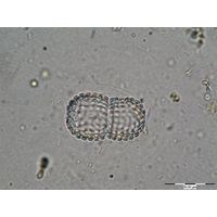 Cosmarium amoenum