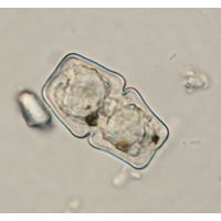 Cosmarium anceps