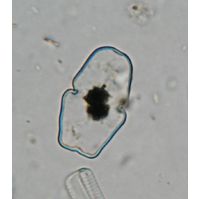 Cosmarium anceps