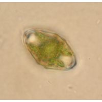 Cosmarium angulare