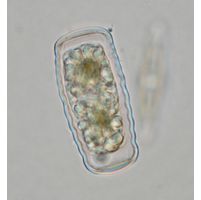 Cosmarium annulatum
