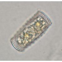 Cosmarium annulatum