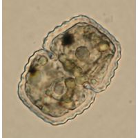 Cosmarium basiornatum