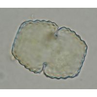 Cosmarium basiornatum