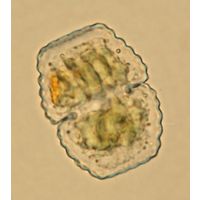 Cosmarium basiornatum