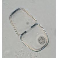 Cosmarium binerve
