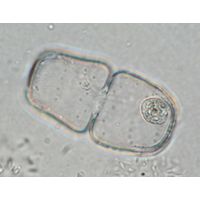 Cosmarium binerve