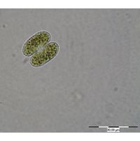 Cosmarium bioculatum