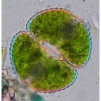Cosmarium botrytis