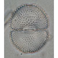 Cosmarium botrytis