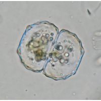 Cosmarium ceratophorum