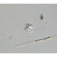 Cosmarium carinthiacum