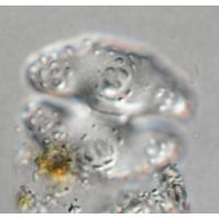 Cosmarium commissurale