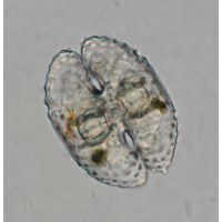 Cosmarium commissurale