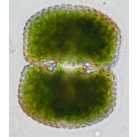 Cosmarium conspersum