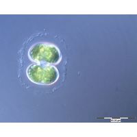 Cosmarium contractum