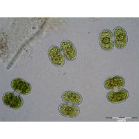 Cosmarium contractum